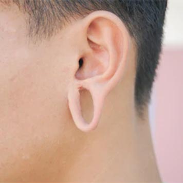 Buraco de Orelha