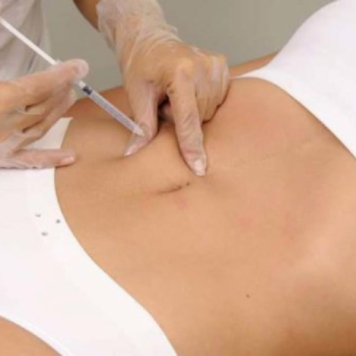 Intradermoterapia