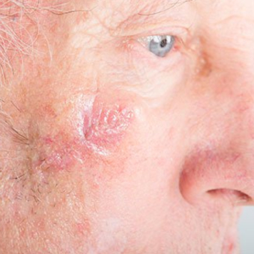 Tratamento de Queimaduras, Traumatismos Faciais e Outros Traumatismos